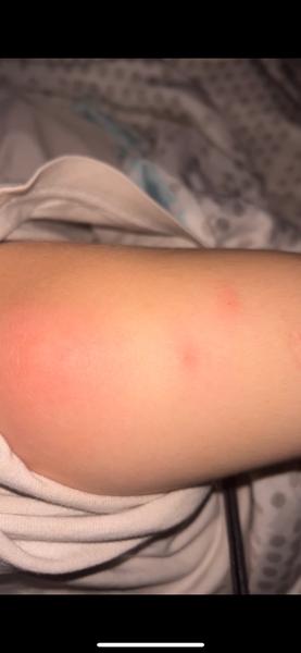 Ráno sa budím s kúsancami