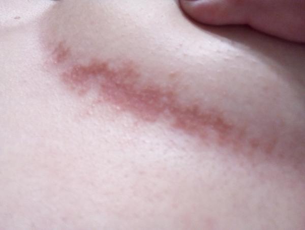 Aké pásy to mám pod prsiami?