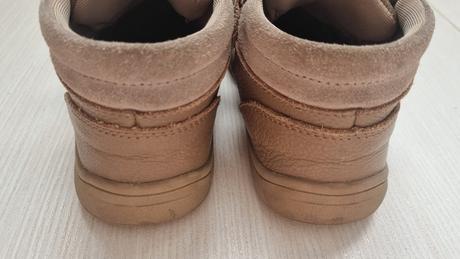 Poltopánky protetika, protetika,30