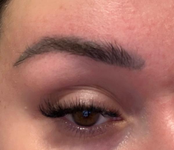 Odstránenie tetovaného obočia