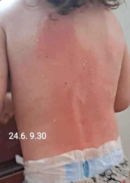 Červený fľak od vody