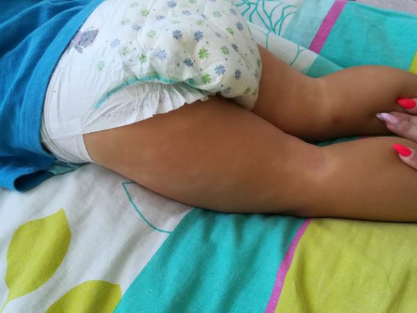 Škvrny a biele fľaky, čo to môže byť?