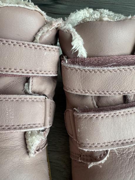 Zimne topanky protetika barefoot, protetika,29