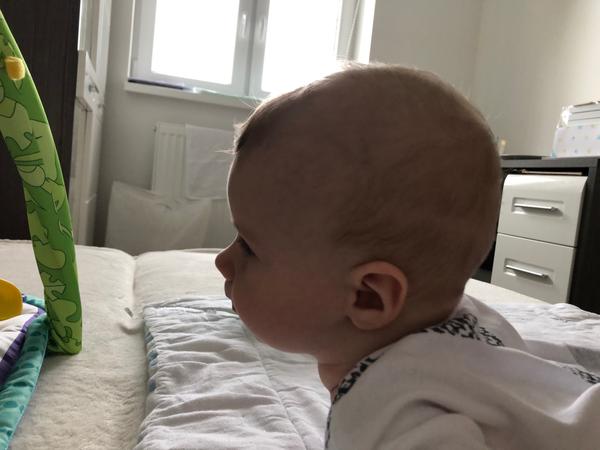 Má môj synček zležanú hlavičku?