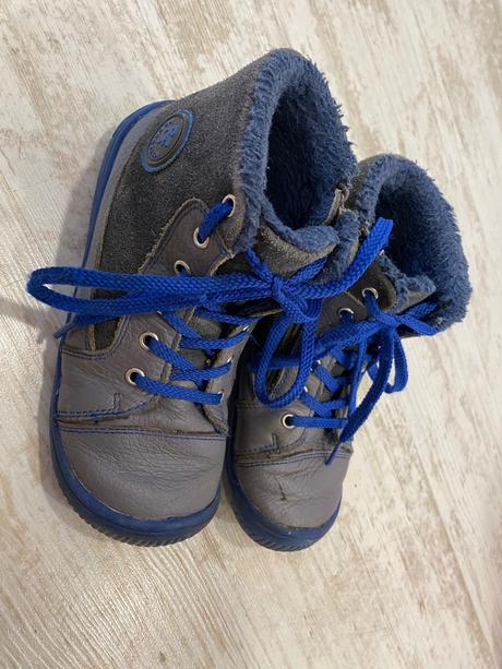 Protetika amis, protetika,30