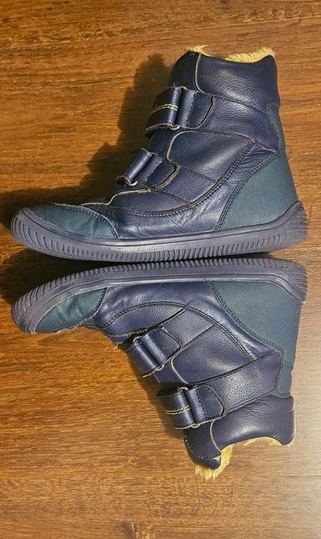 Zimne protetika toren v. 33, protetika,33