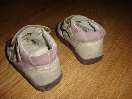 Botičky protetika, protetika,20