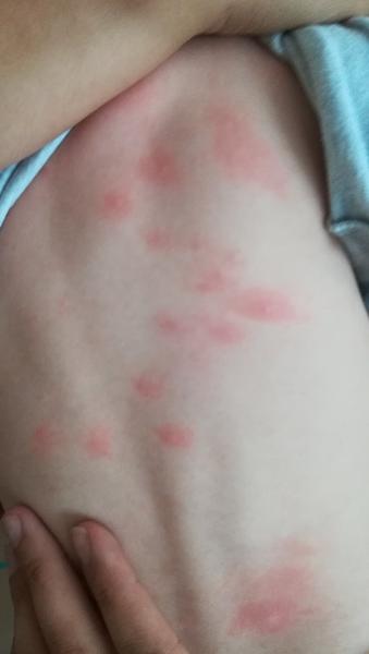 Sú to štípance alebo potničky?