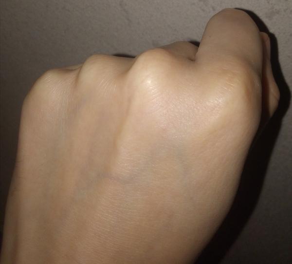 Môže to byť skákavý prst?