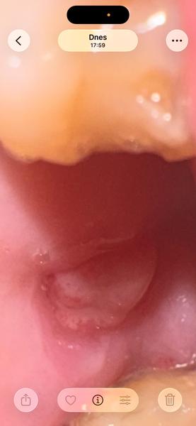 Co môže byt toto,treba ísť k zubárovi..