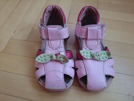 Sandálky, protetika,23
