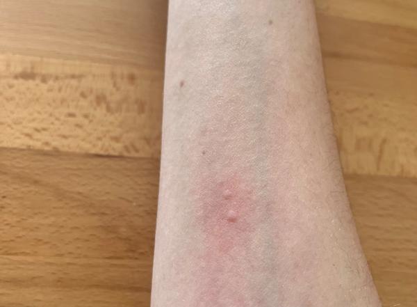 Čo naznačujú bodky po kontakte so zvieraťom?