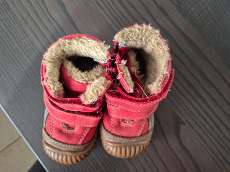 Čižmy, protetika,20