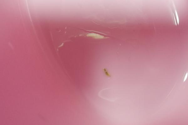 Môže to byť parazit?