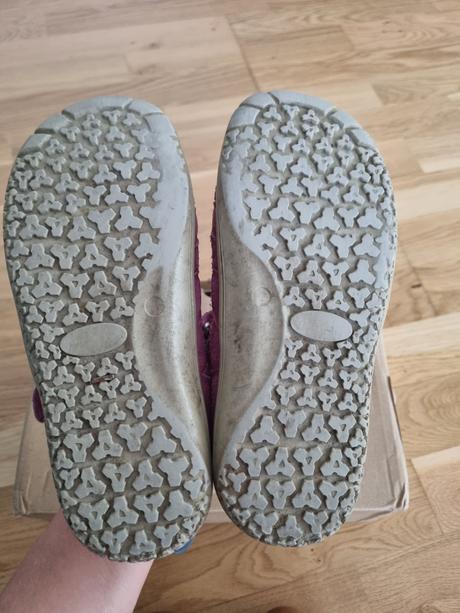 Protetika sandalky, protetika,32