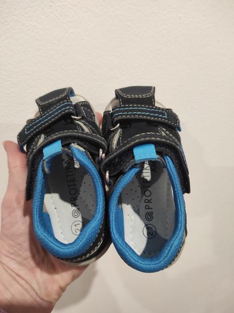 Nové sandálky, protetika,21