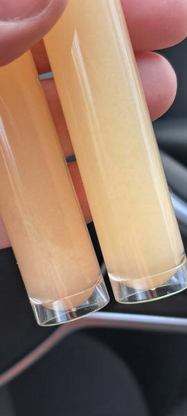 Čo znamená kalný moč?