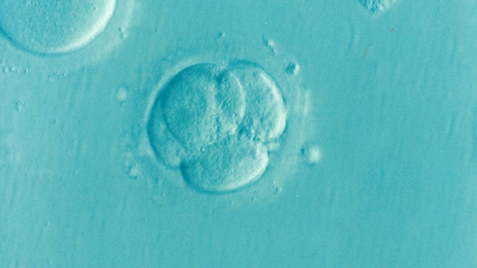 Embryo Embryo