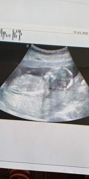 Výsledky na DS v 18. týždni