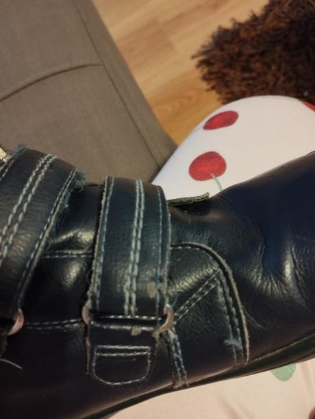 Barefoot zimne topanky, protetika,30