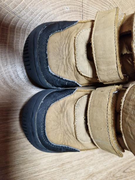 Barefoot protetika, protetika,28