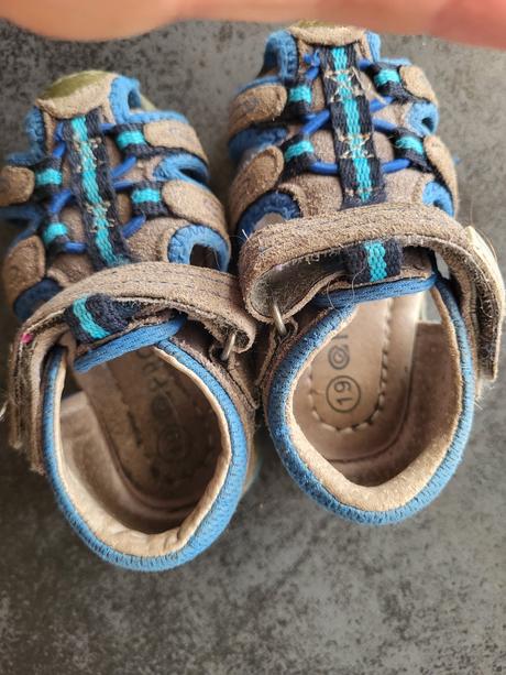 Sandálky protetika, protetika,19