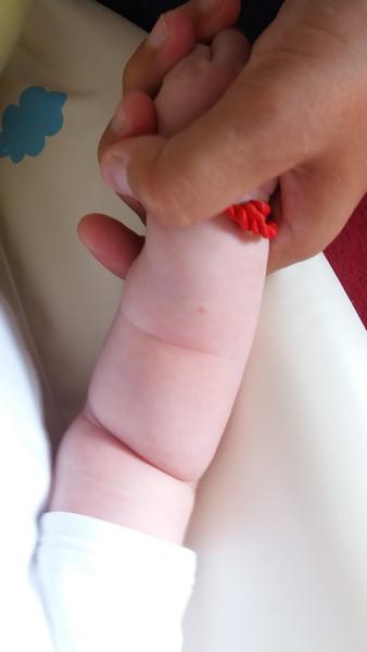 Vyrážky na bábätkových ručičkách