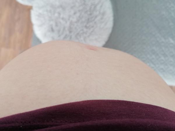 Hlavička hore v 33. týždni tehotenstva?