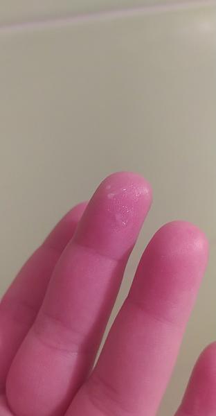 Nafúknuté brucho a hlien