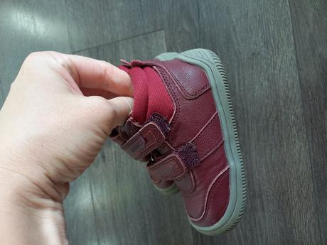 Prechodne topancky ako nove, protetika,21