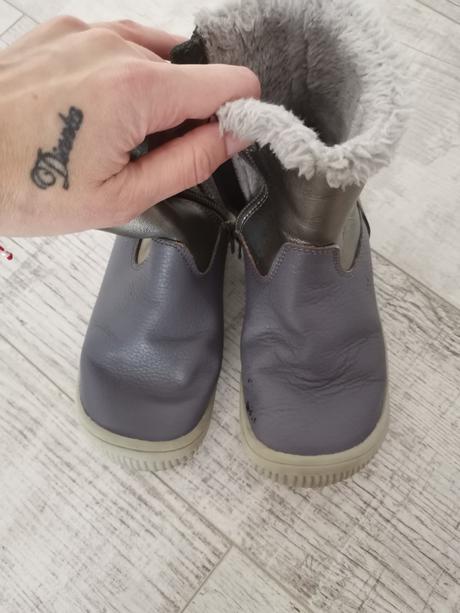 Protetika lory, protetika,31