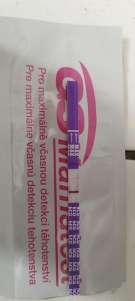 Ako správne interpretovať výsledky moču?