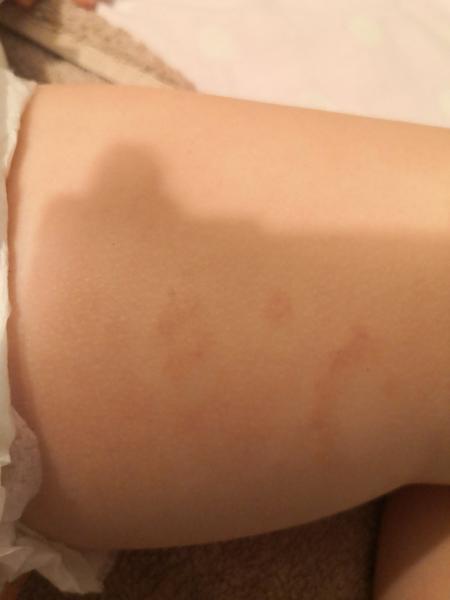 Čo to má moje dieťa na nohách?