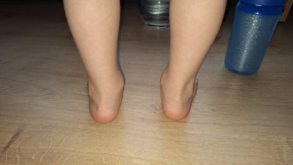 Aké značky tenisiek a sandálov sú vhodné pre dieťa, ktoré neznesie veľký nadmerok?