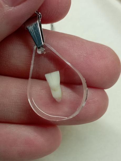 Prívesok na pamiatku so zúbkom, 