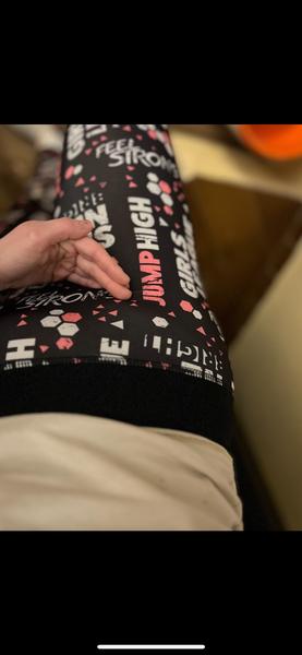 Čo spôsobuje bolesť v pravej slabine?