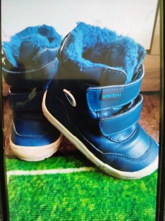 Topánočky protetika, protetika,23