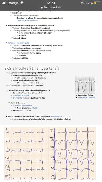 Dá sa na EKG zistiť itrakraniálna hypertenzia?