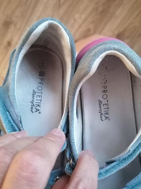 Sandále / prezuvky, protetika,35