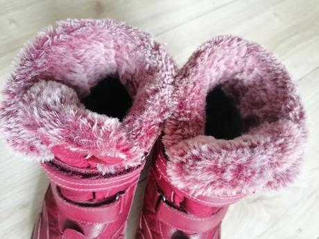 Zimné topánky protetika, protetika,36