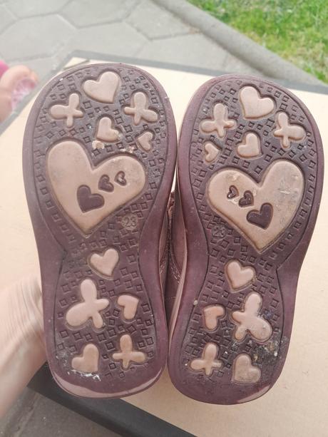 Protetika, protetika,23