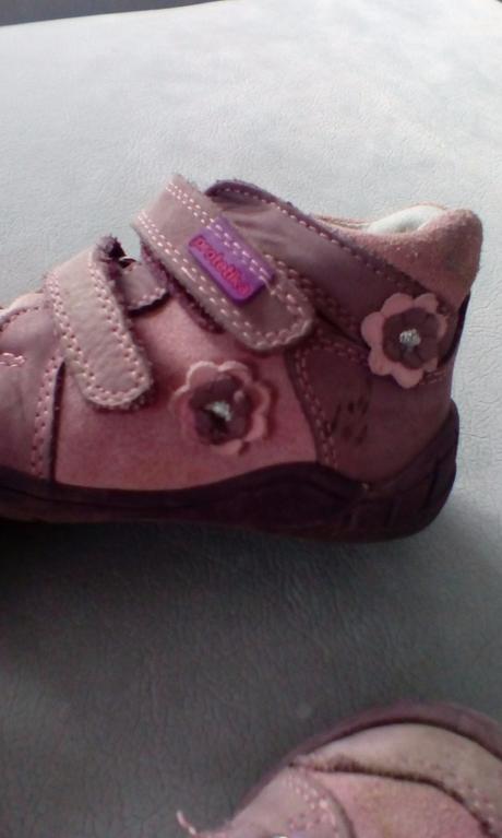 Prechodné topánočky protetika, protetika,22