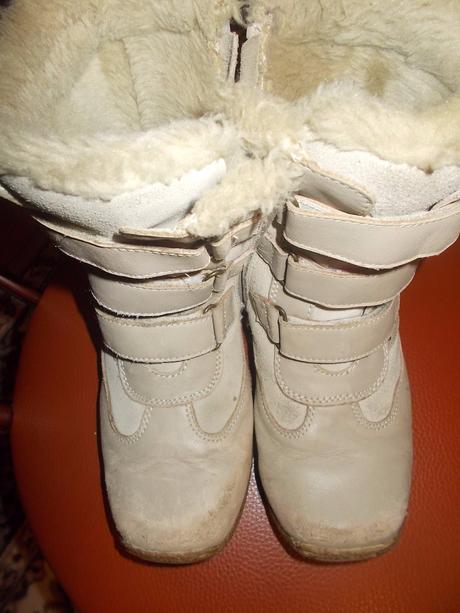 Topanky protetika na donosenie, protetika,34