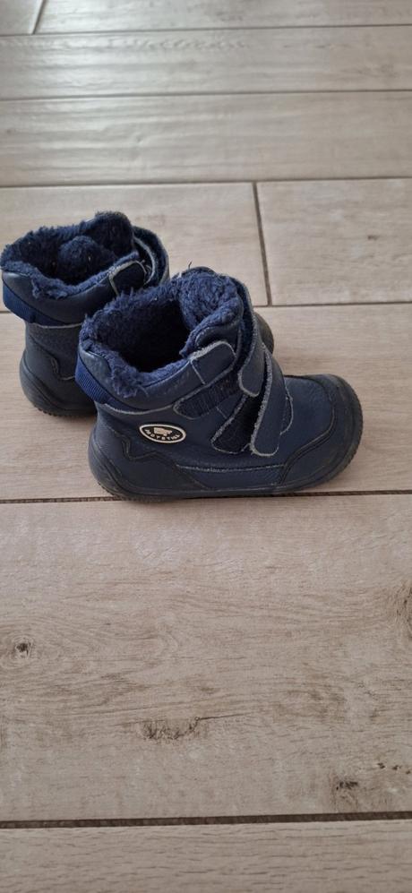 Protetika topanky, protetika,21