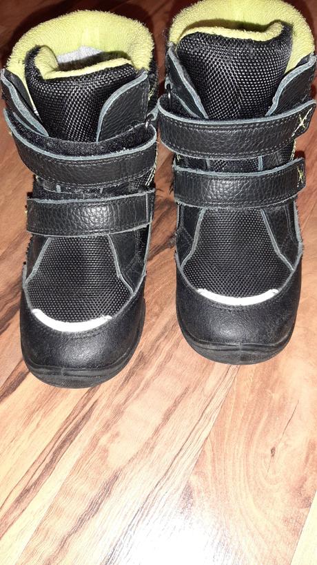 Zimne cizmicky, protetika,29