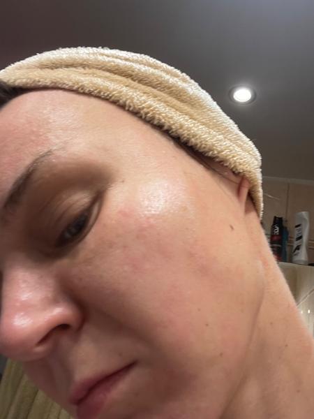 Mám intoleranciu na lepok?