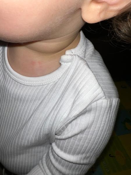 Aký hnedý flak má môj syn na krku?