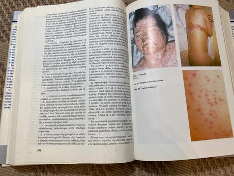 Vnútorné lekárstvo 2 dionýz dieška kolektív autor,