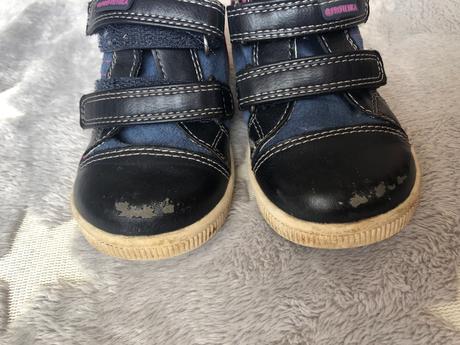 Topánky 21, protetika,21