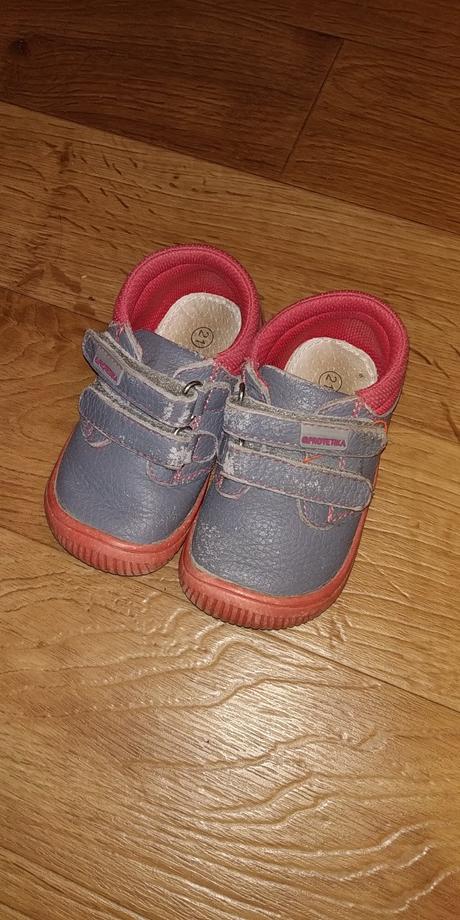 Protetika rony koral, protetika,21